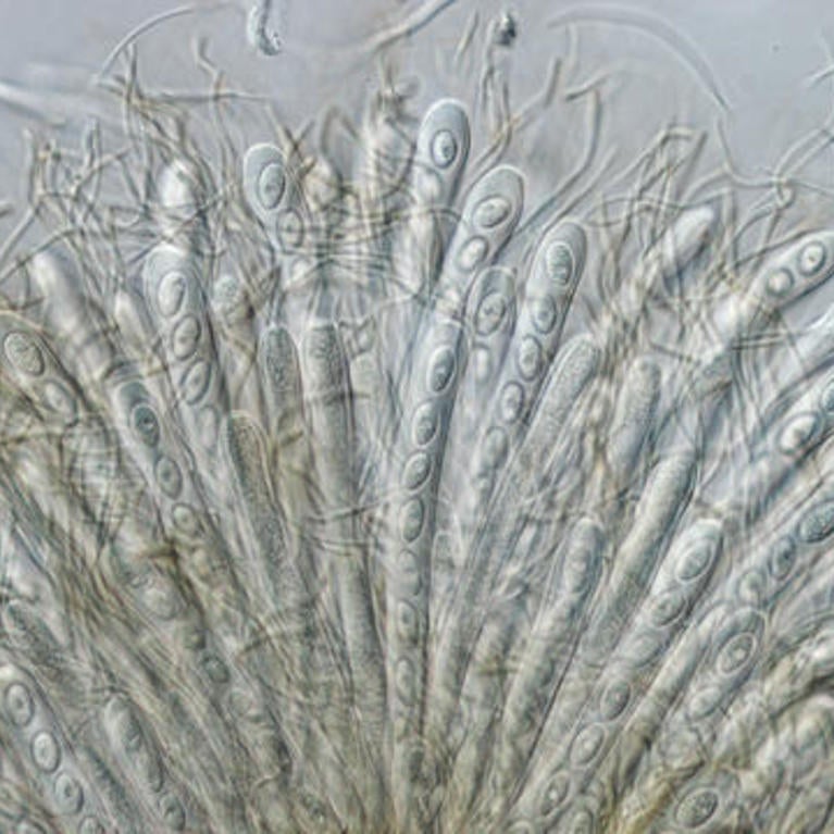 Microscopy Image Aronson Lab Research 